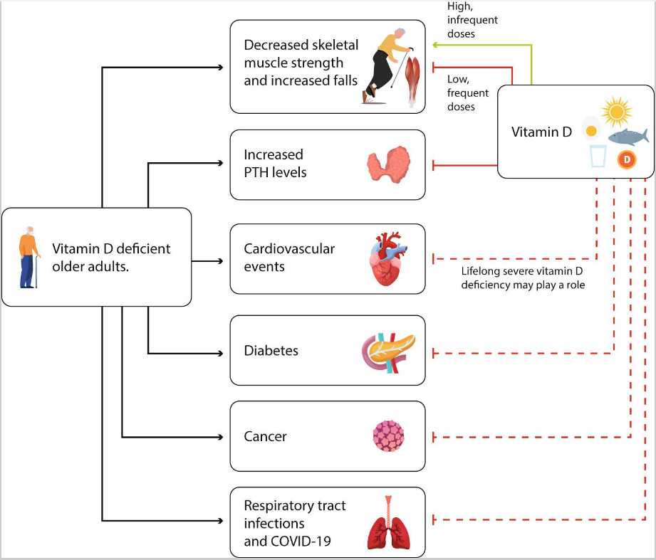 老年人缺乏維生素D對(duì)骨骼的額外影響以及維生素D的預(yù)防作用